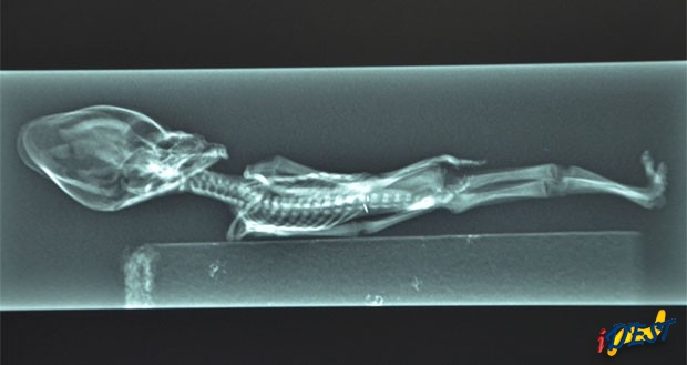 Radiografia do humanoide em cena do filme &prime;Sirius&prime;