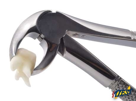 O odontoma é um tumor dentário benigno.